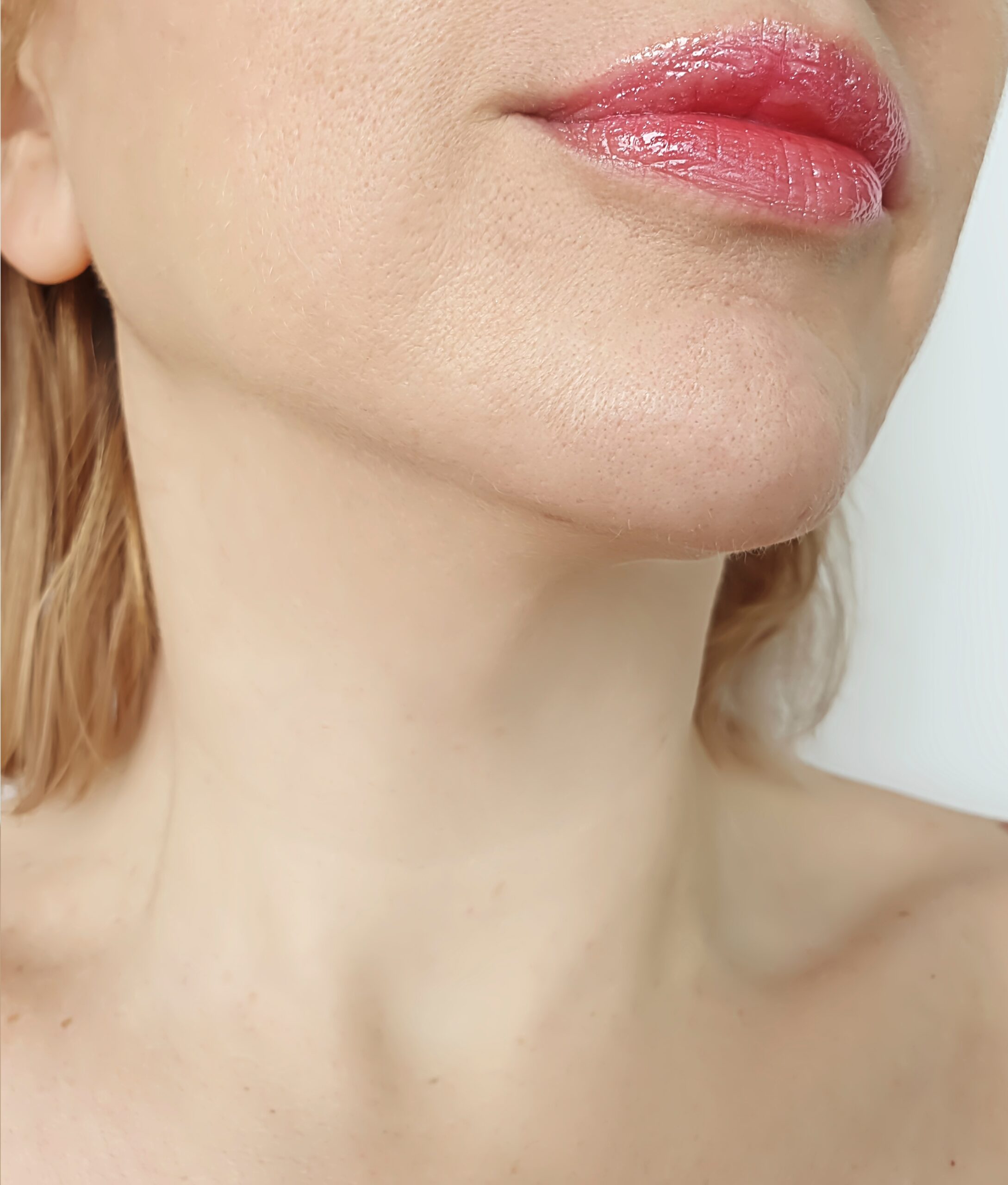 jaw reduction after
