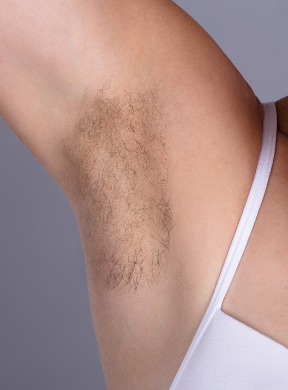 laser hair removal before